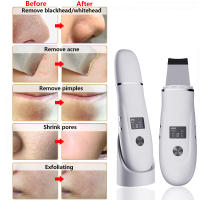 Limpiador De Piel Con Ultrasonidos Eliminador De Quistes Faciales Herramienta De Limpieza Profunda Para Eliminar Acné Y Quistes Negro Espátula Facial USB Recargable Metal - details 10