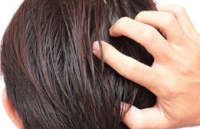 Células muertas, cabello graso