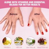 2 Pares De Guantes Y Calcetines Hidratantes Para Cuidado De Manos Y Pies Con Callos Anti-Derrapantes Gel De Silicona Herramientas De Manicura Para Piel Seca Y Agrietada - details 5