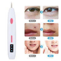Mini Mole Pincel Eléctrico Para Eliminar Manchas De Grasa Verrugas Y Tatuajes Sin Dejar Marcas Ni Cicatrices Carga Directa Plug-In - details 4