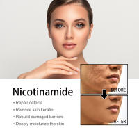 La esencia facial de niacina EELHOE atenúa las marcas del acné, hidrata, reduce los poros, blanquea la piel y embellece la piel. - details 5