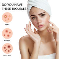 Parches Antipicas Para Acne Tratamiento Hidratante De Parches Impermeables Eliminador De Acne Herramienta Para Manchas De La Piel Cuidado Facial - details 2