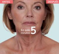 REMESCAR Cuello y Escote Reafirmante Lifting Instantáneo – Antiarrugas, Efecto Tensor Inmediato, Tratamiento Antiedad 40ml - details 0