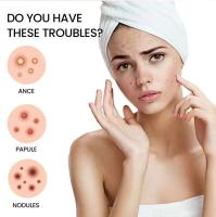 200pcs Parches De Reparación Para Acné Facial Cuidado De La Piel Elimina Manchas De Espinillas Y Acné Parches Para Cubrir Y Reparar - details 3