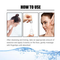 La esencia facial de niacina EELHOE atenúa las marcas del acné, hidrata, reduce los poros, blanquea la piel y embellece la piel. - details 4