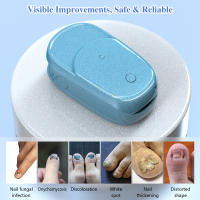 Dispositivo De Láser Para Tratamiento De Uñas Fungosas Azul 7 Minutos Tratamientos Sin Dolor Curación De Onicomicosis Máquina 905nm LLLT Para Uñas Y Dedos - details 2