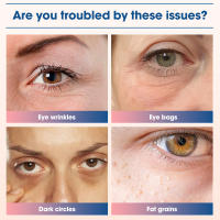 Dispositivo De Belleza Para Los Ojos EMS Microcorriente Con Masaje Eléctrico Y Terapia De Luz Roja Reducción De La Fatiga Ocular Y Circunferencias Oscurecidas - details 3