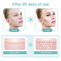 Mini Dispositivo Hifu 2024 Para Levantamiento Facial EMS Masajeador De Rostro Microcorriente Herramientas De Cuidado De La Piel Antiarrugas Y Rejuvenecimiento - details 11