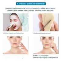 Juego De 4 Herramientas Para Eliminar Quistes Y Puntos Negros En La Piel Limpiador De Poros Set De Herramientas De Cuidado De La Piel - details 6