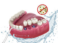 Irrigador Dental Aquapik 100 + Pasta Dental Blanqueadora Opalescence de Regalo - details 1