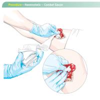 Gasa De Hemostasia De Kaolin Para Primeros Auxilios Tácticos En Emergencias Traumáticas Z-Fold Soluble Para Kit Médico De Primeros Auxilios Militar - details 4