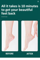 Kit De Pedicura Profesional 8-en-1 Para Pies Suaves Y Lisos Con Herramientas De Acero Inoxidable De Ouriner - details 9