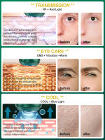 Dispositivo De Belleza RF 4en1 Masajeador Facial EMS Levantamiento Y Acondicionamiento De Piel Con Terapia De Luz LED Antiarrugas Y Blanqueamiento - details 11