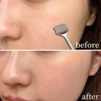 Doble Cabeza Limpiador De Acné Y Quimioscogador De Hierro Fundido Herramienta De Cuidado De La Piel Extractor De Blackhead Beauty Remover Scooper Maquillaje - details 5