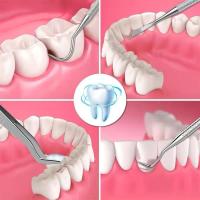 Kit De Limpieza Dental Profesional Con 3/4/5/6/7pcs Palillos De Dientes De Acero Inoxidable Para Eliminar Callo Y Placa Herramientas Dentales - details 7