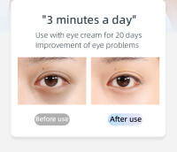 Dispositivo De Belleza Para Los Ojos BoSidin EMS Microcorriente Antiarrugas Elimina Bolsas Y Círculos Oscuros Terapia De Luz Elevación Y Masaje Instrumento Para La Piel - details 7