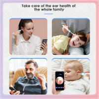 Limpieza de ojos visual, HD 1080p con 6 Luces LED, al Agua Resistente, con Cámara, compatible con WiFi, Adaptado para adultos, niños y mascotas. - details 4