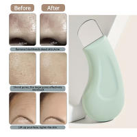 Herramienta De Limpieza De Poros Para Rostro Y Nariz Eliminador De Quistes Y Puntos Negros Para Mujeres Cuidado De La Piel Tamaño 6cm Plástico No Eléctrico - details 0