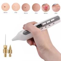 Bolígrafo De Plasma LCD Profesional Para Eliminar Vello Pintado Manchas De Piel Arrugas Línea De Tiempo Dispositivo De Belleza Para El Rostro - details 4