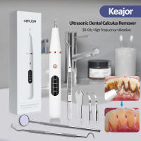 Limpia Dientes Ultrasonido Eliminador De Calcafores Y Placa Eléctrico Herramienta Para Limpieza Oral Eliminador De Manchas Y Piedras Dentales - details 0