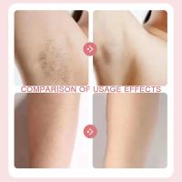 Nueva Razor Eléctrica Para Mujer 2 En 1 Trimmer De Bikini Y Afeitadora Para Cara Y Axilas Peluca Eliminación IPX7 Impermeable Para Piernas Y Boca - details 1