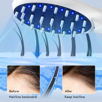 Peine de masaje eléctrico con luz roja y azul para masaje del cuero cabelludo, peine medicinal para el cuidado del cabello. - details 7