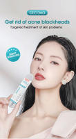 Juego De Agujas Para El Acné Y Eliminación De Quistes Cutáneos Herramienta De Belleza Ultrafina Para El Rostro Eliminación De Puntos Negros - details 0
