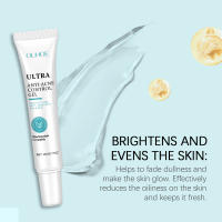 Gel limpiador para el acné OUHOE, gel hidratante con niacinamida para el acné, limpiador suave que reduce la grasa y atenúa el acné. - details 6