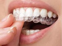 10 Férulas de Descarga Nocturna Perfecta | Ideal Contra Bruxismo, Rechinar los Dientes, Trastornos del ATM, Bandeja blanqueador | Protectores Dentales Ajustables + 1 Estuche | Calidad Médica Sin BPA - details 10