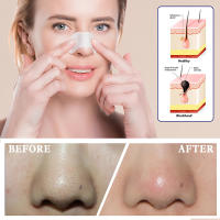 Mascarillas Para Eliminar Quistes Negros 6pcs Set De Cuidado De La Piel Unisex Para Un Profundo Limpiado Y Reducción De Poros - details 4