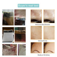 Limpieza Facial Profunda Con Scrubber Ultrasonido Eliminador De Quistes Faciales Y Puntos Negros Espátula De Poros Ultrasonido Scrubber De Piel Recargable - details 8