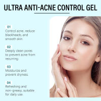 Gel limpiador para el acné OUHOE, gel hidratante con niacinamida para el acné, limpiador suave que reduce la grasa y atenúa el acné. - details 4