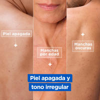 MIXA | Crema, Loción Corporal y/o aceite corporal anti estrias con niacinamida antimanchas e iluminadora para una piel sana, radiante y un tono uniforme. - details 2