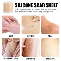 Cinta De Reparación De Marcas Silicone Gen 1 Para Rostro Y Cuerpo Eliminación De Acné Cuidado De La Piel Sin Electricity - details 9