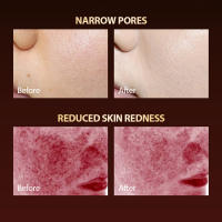 Máscara De Luz LED Para El Rostro Con 7 Colores Terapia De Silicona Fotón Belleza Para Levantar La Cara Anti-Arrugas Control De Aceite Blanqueamiento Y Reparación De Piel - details 5