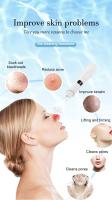 Máquina De Limpieza Facial Con 3 Modos De Succión Eliminador De Piel Muerta Y Quimioterapia USB Recargable Para Eliminar Blackheads Y Blemishes - details 3