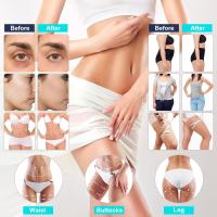 Cecodadi-Máquina profesional de cavitación ultrasónica 40khz, moldeado del cuerpo, liposucción y adelgazamiento - details 2