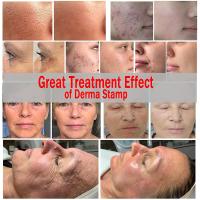 Sistema De Rollo De Agujas Microneedoras Derma Stamp DRS 140A Con Agujas Ajustables Para Tratamiento De Pérdida De Cabello Y Crecimiento De Barba Herramienta De Terapia De Microneedling - details 3
