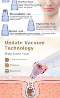 Instrumento De Succión De Puntos Negros Y Quemaduras De Acné Limpiador De Piel Facial USB Recargable ABS Sin Químicos De Alta Potencia - details 3