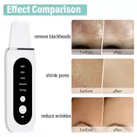 Limpieza Facial Profunda Con Scrubber Ultrasonido Eliminador De Quistes Faciales Ionizador De Poros Acné Limpieza De Piel Rechargeable Battery - details 3