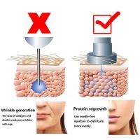 Pluma De Hialurón 2 En 1 Inyección Meso Reducción De Imperfecciones Arrugas Aumento De Labios Atomizador Con Presión Ajustable Para Cuidado De La Piel - details 7