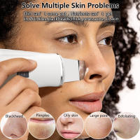 Limpiador De Piel Con Ultrasonidos Eliminador De Quistes Faciales Herramienta De Limpieza Profunda Para Eliminar Acné Y Quistes Negro Espátula Facial USB Recargable Metal - details 1