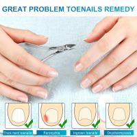 YIKOOLIN Cortauñas Profesional Portátil Tijeras De Cutícula Herramienta De Manicura Y Pedicura Para Uñas Y Tendones De Pie Material Acero Inoxidable - details 3