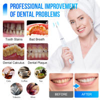 Limpieza Dental Ultrasonica 7en1 Escáner Dental Eléctrico Eliminador De Calcafores Sonic Limpieza De Dientes Con Varias Modos De Funcionamiento Para Limpieza Profunda Y Masaje - details 3
