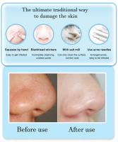 Máquina De Limpieza Facial Con 3 Modos De Succión Eliminador De Piel Muerta Y Quimioterapia USB Recargable Para Eliminar Blackheads Y Blemishes - details 6