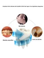 Cepillo De Dientes Eléctrico Ultrasonido Inalámbrico Para Adultos En U Con Carga Silicona Impermeable Vibración 360 Grados - details 4