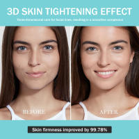 New beauty instrument pore astringent beauty instrument EMS skin rejuvenation micro-current introduction instrument blue light 5 gears - details 6