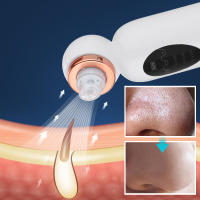 Limpiador de Poros Electrico Succionador, Limpiador Facial Ajustable de 3 Modos, Equipado con 6 Cabezales de Succión Reemplazables, Limpiador Facial con Pantalla LED, Adecuado para Hombres y Mujeres, san valentin regalos mujer - details 4