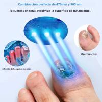Dispositivo Láser KTS Para El Tratamiento De Hongos En Uñas De Los Pies Y Manos 12x470nm 6x910nm Con Pantalla De Tiempo 2000mA Portátil Y De Fácil Uso - details 1