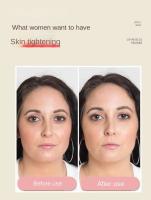 Ejercitador De Cara Y Cuello En V Levantador De Pecho Y Afirmador De Piel Ejercitador De Mentón Portátil Entrenador Facial - details 2